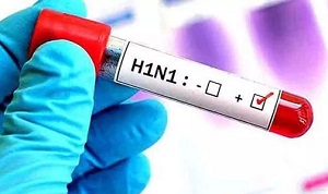 स्वाइन फ्लू