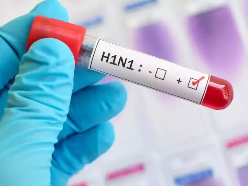 स्वाइन फ्लू