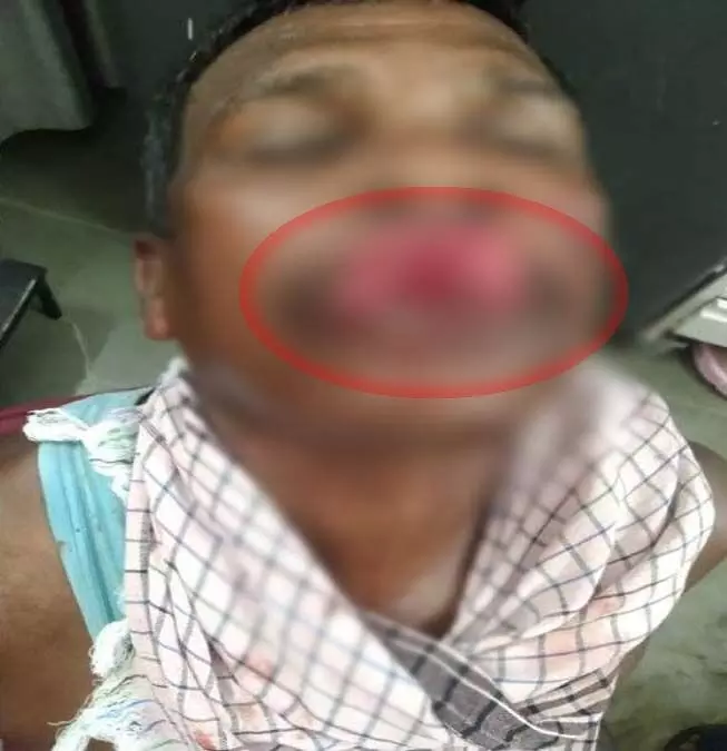 कुत्ते ने