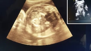 प्रेग्नेंट महिला