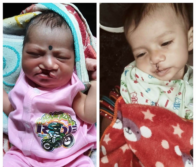 चिरायु योजना